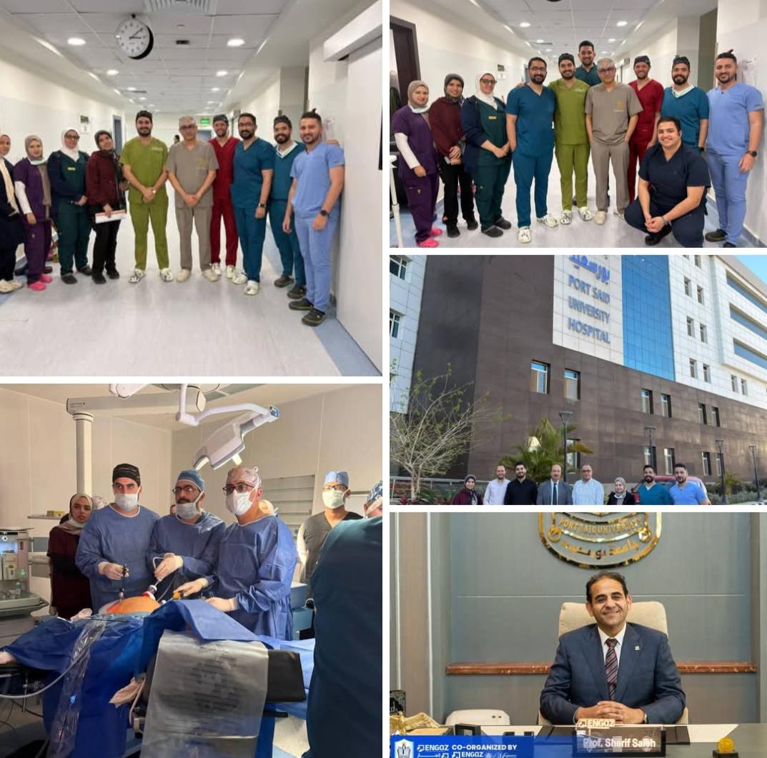 رئيس جامعة بورسعيد مستشفى الجامعة يواصل تقديم خدماته للمجتمع ويعلن عن تحقيق اول عملية استئصال قولون بالمنظار ويثنى على الفريق الطبي والتمريضي على هذا الجهد المتميز