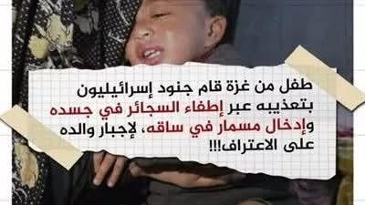 جريمة إنسانية وحشية إسرائيل تعذَب طفلاً فلسطينيا عمره عامين