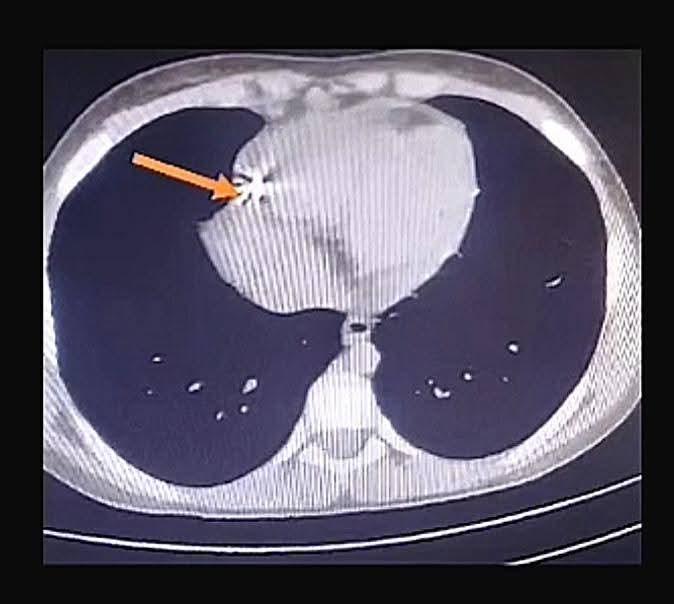 FB_IMG_1775308753922