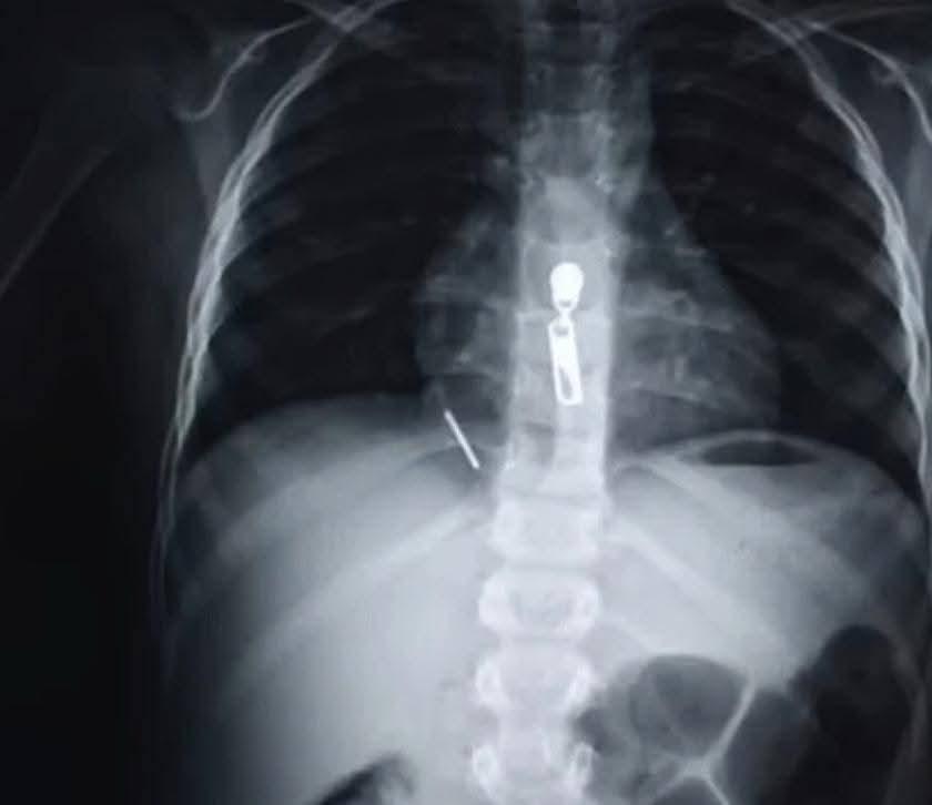 FB_IMG_1775308756605